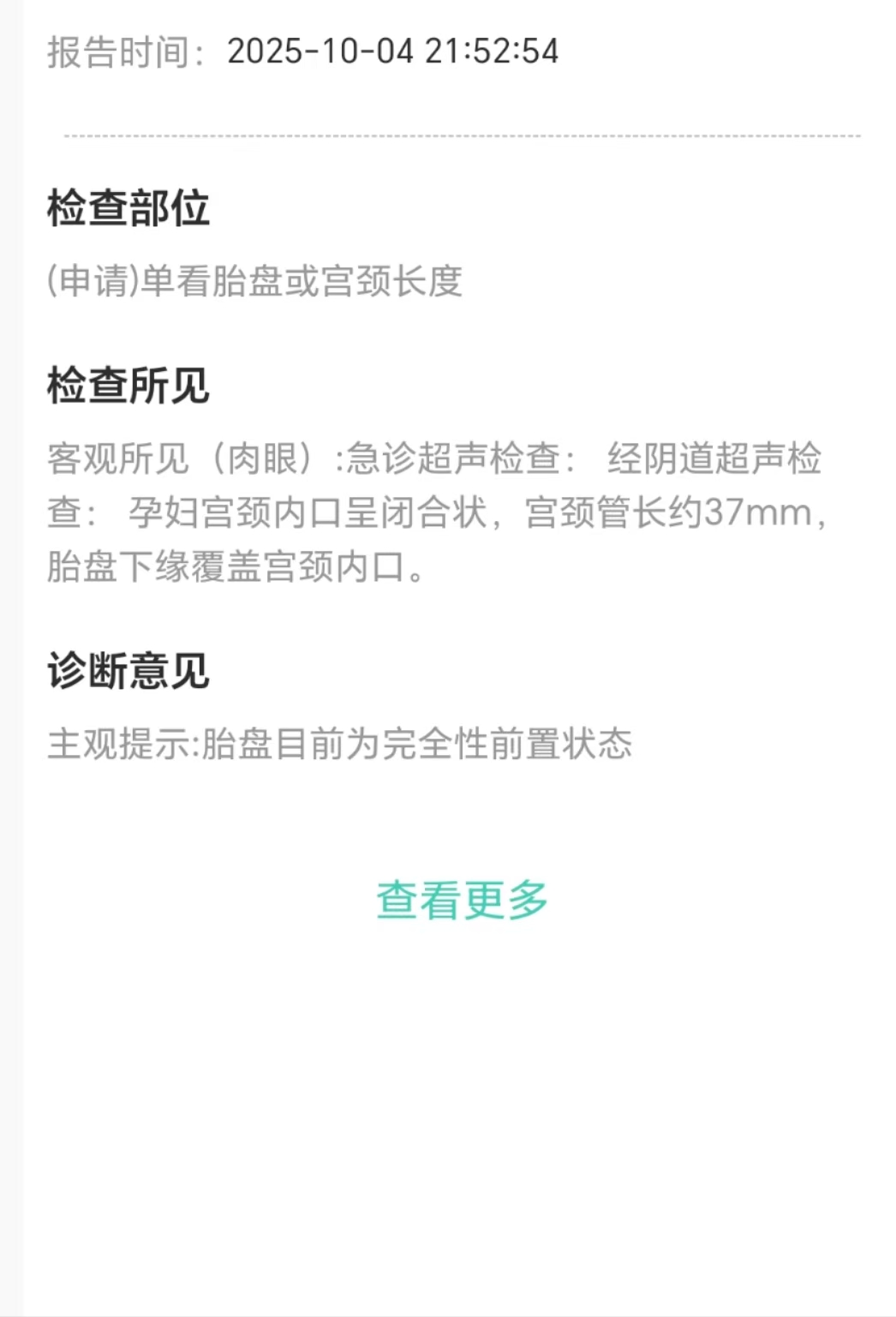 孕期宫缩经历分享