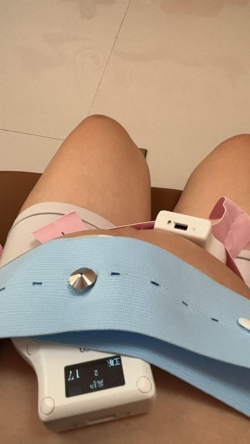 孕晚期胎心监护的忐忑经历