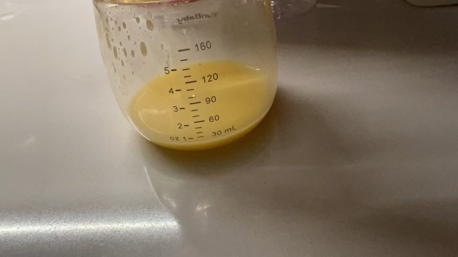 二胎剖腹产前的忐忑与经验分享