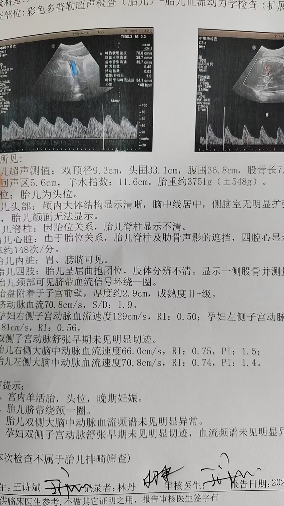 孕期运动与分娩方式的选择