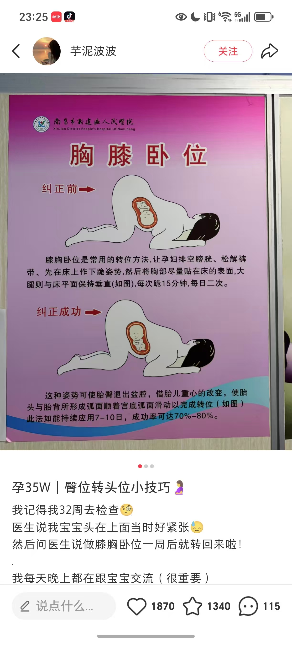 孕期运动与胎位调整的烦恼