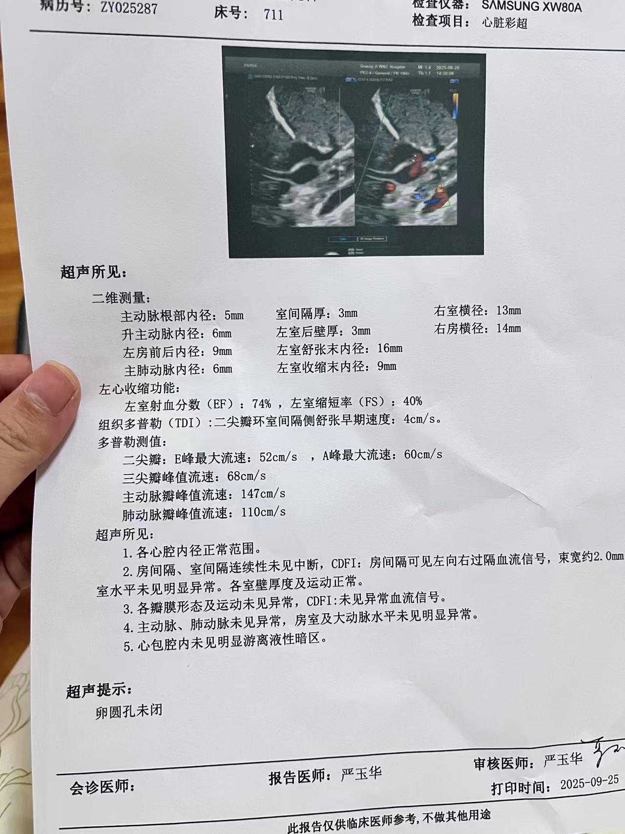 母乳喂养与吸奶器使用心得