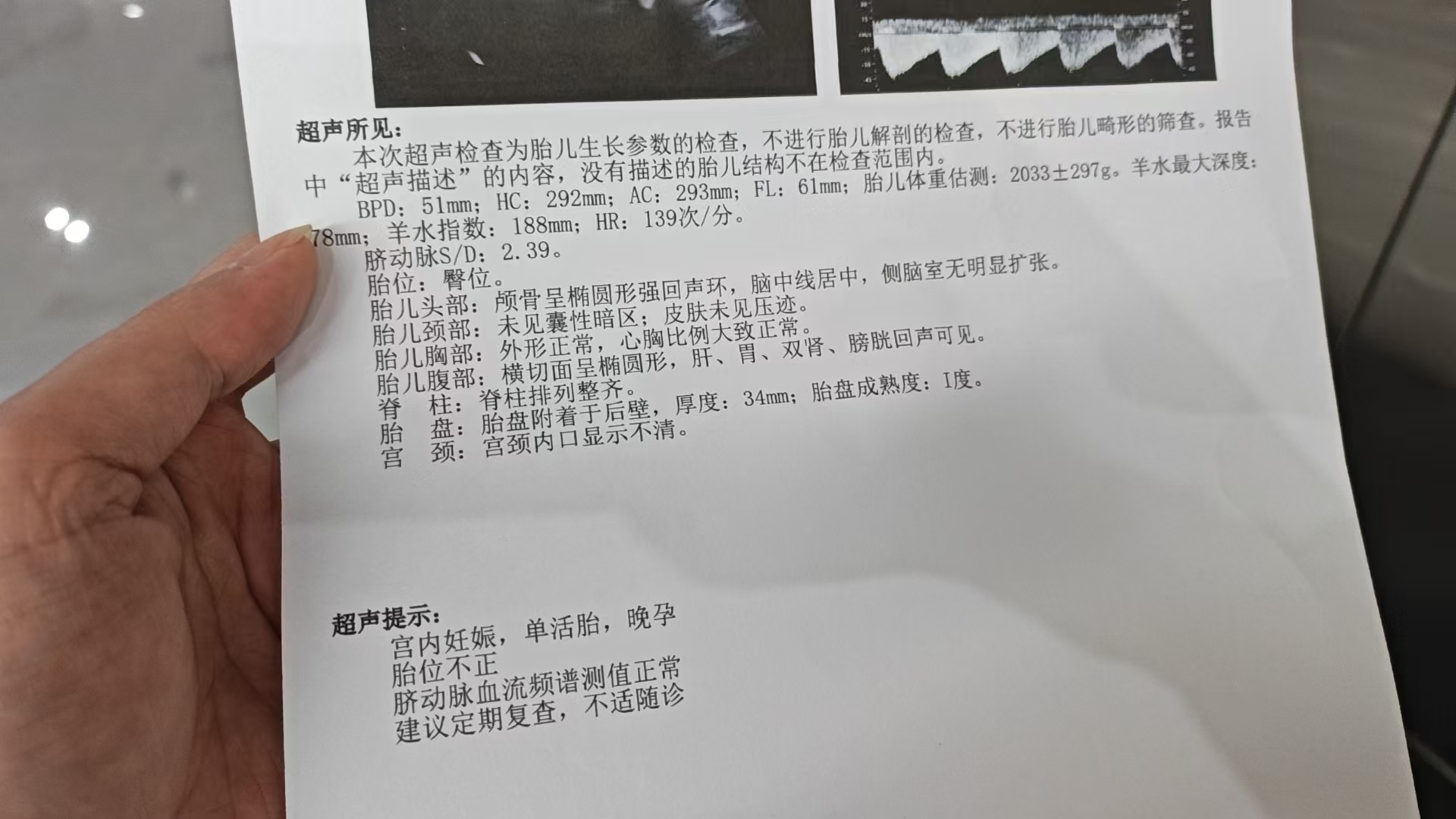 孕期运动与胎位调整的烦恼