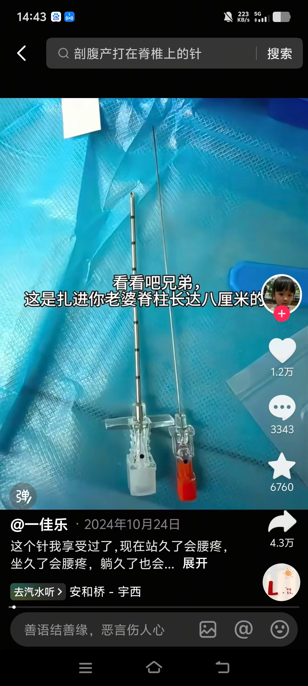 剖腹产经验分享