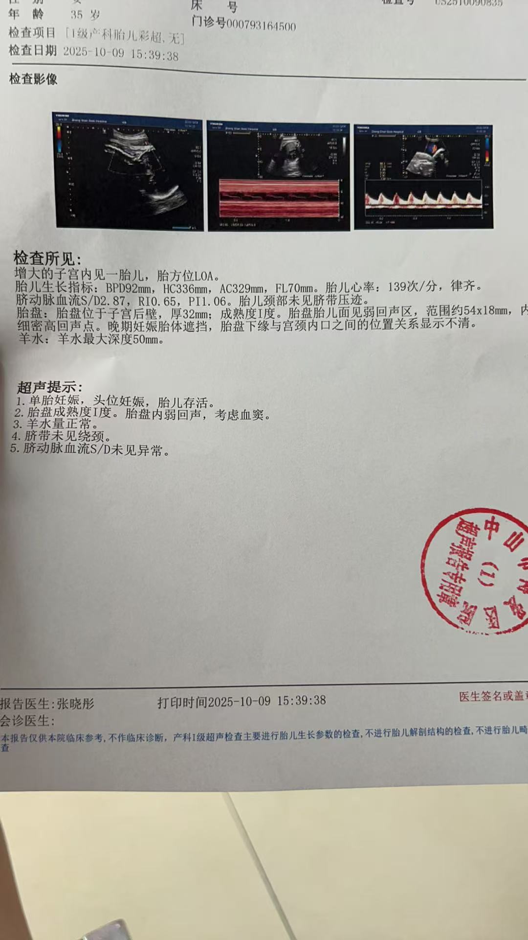 孕晚期胎动异常，紧急就医检查