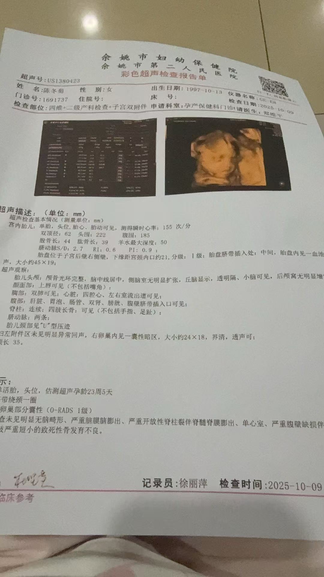 孕期四维彩超的那些事儿