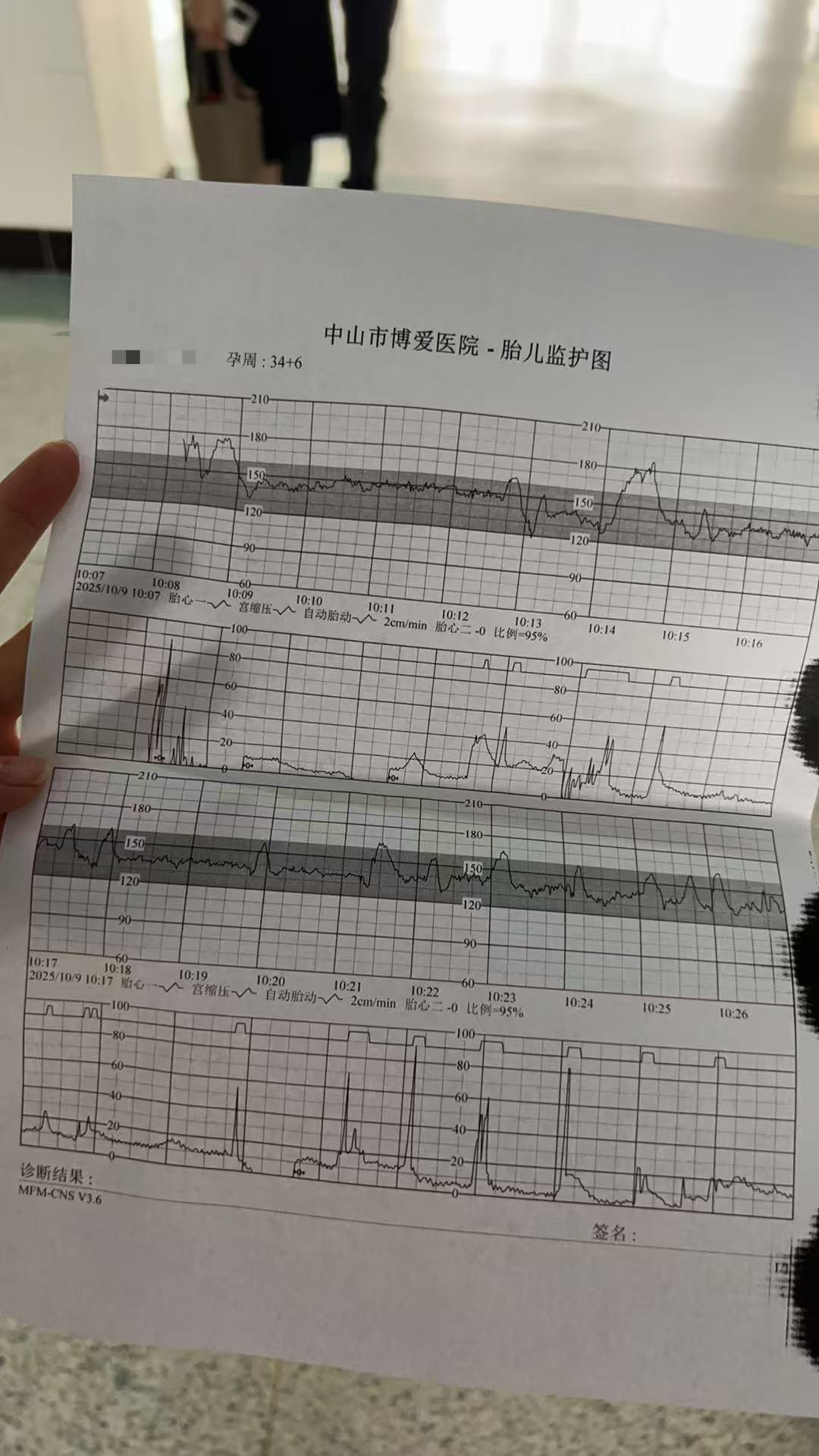 孕晚期胎动异常，紧急就医检查