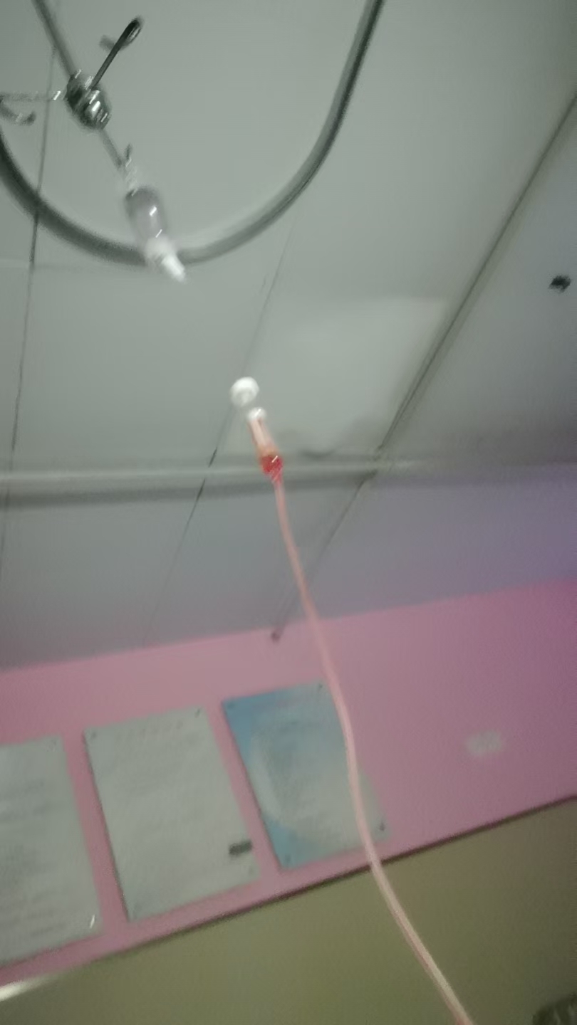 孕期焦虑：二剖比一剖更疼吗？