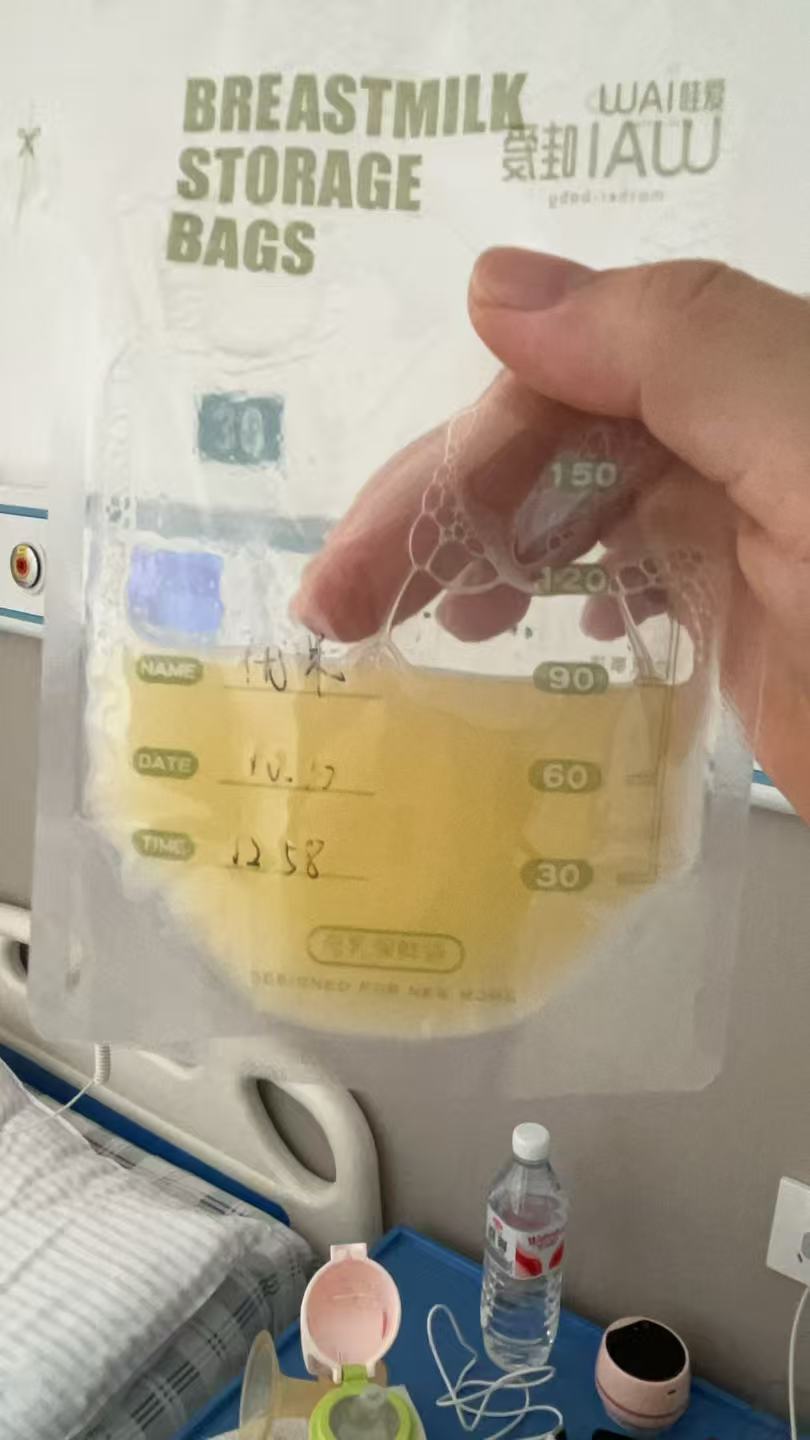 剖腹产妈妈的母乳喂养初体验