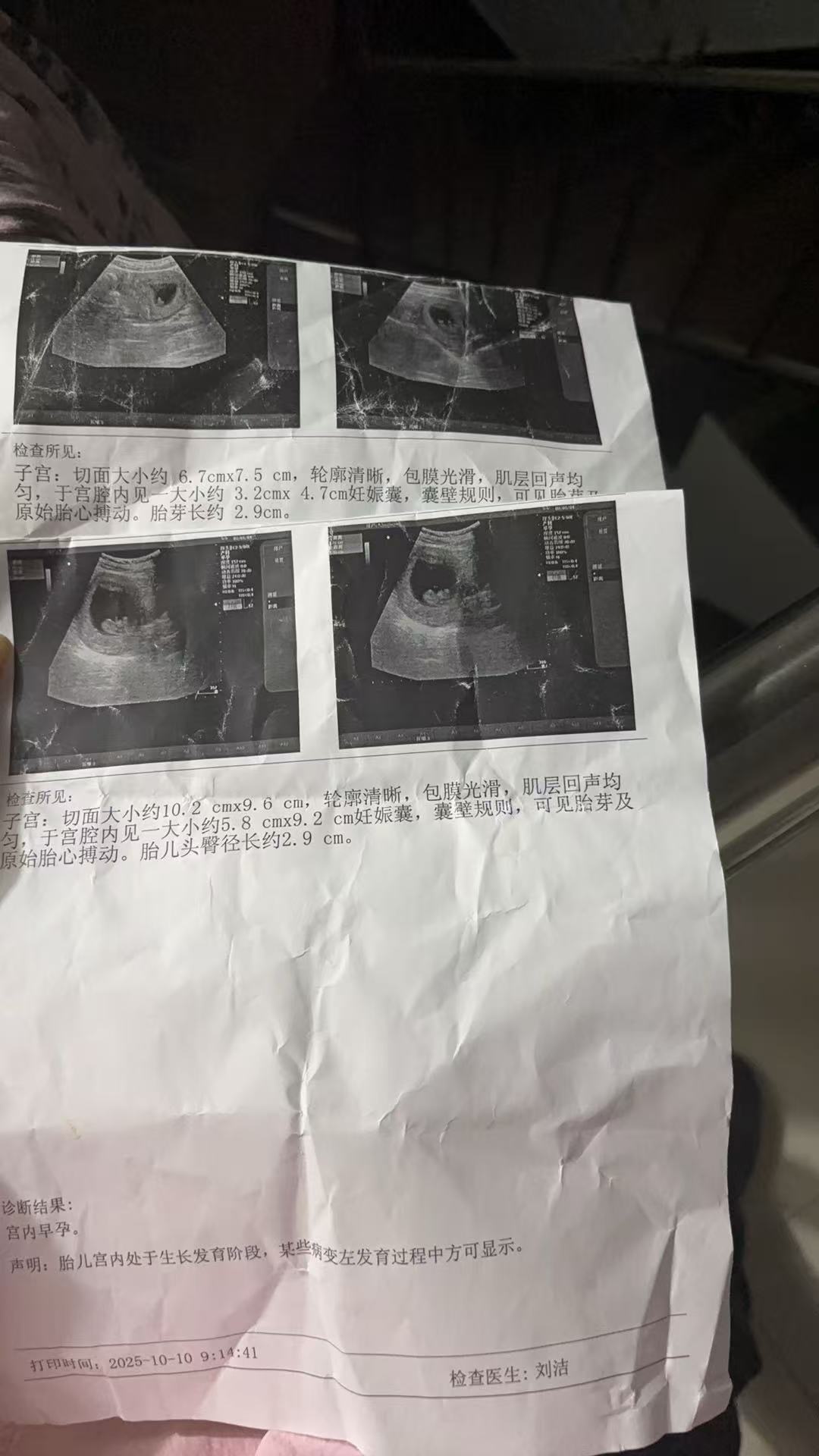 孕早期检查发现胎芽一周没长，好焦虑