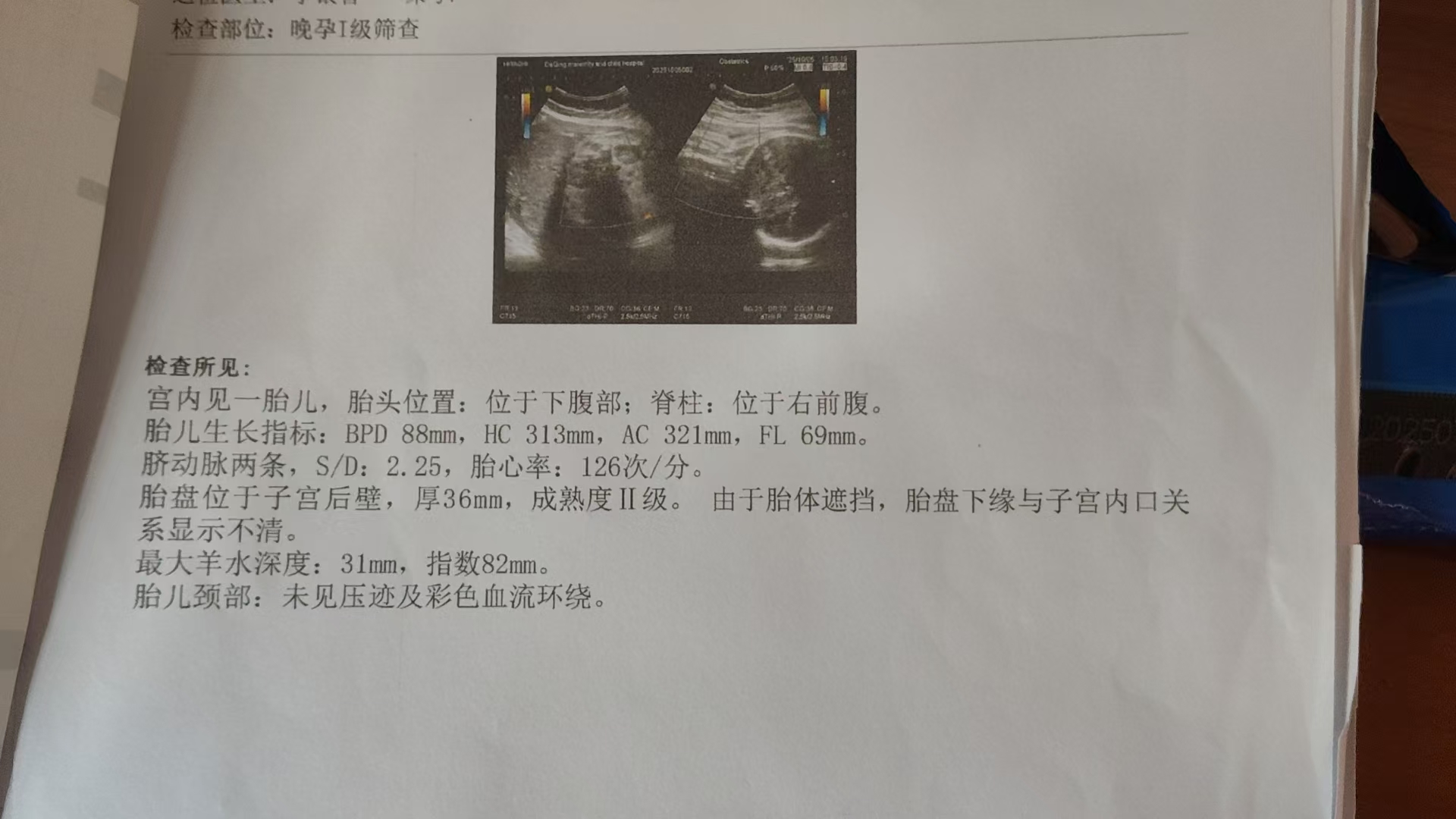 孕晚期浑身酸痛难忍，姐妹们有同感吗？