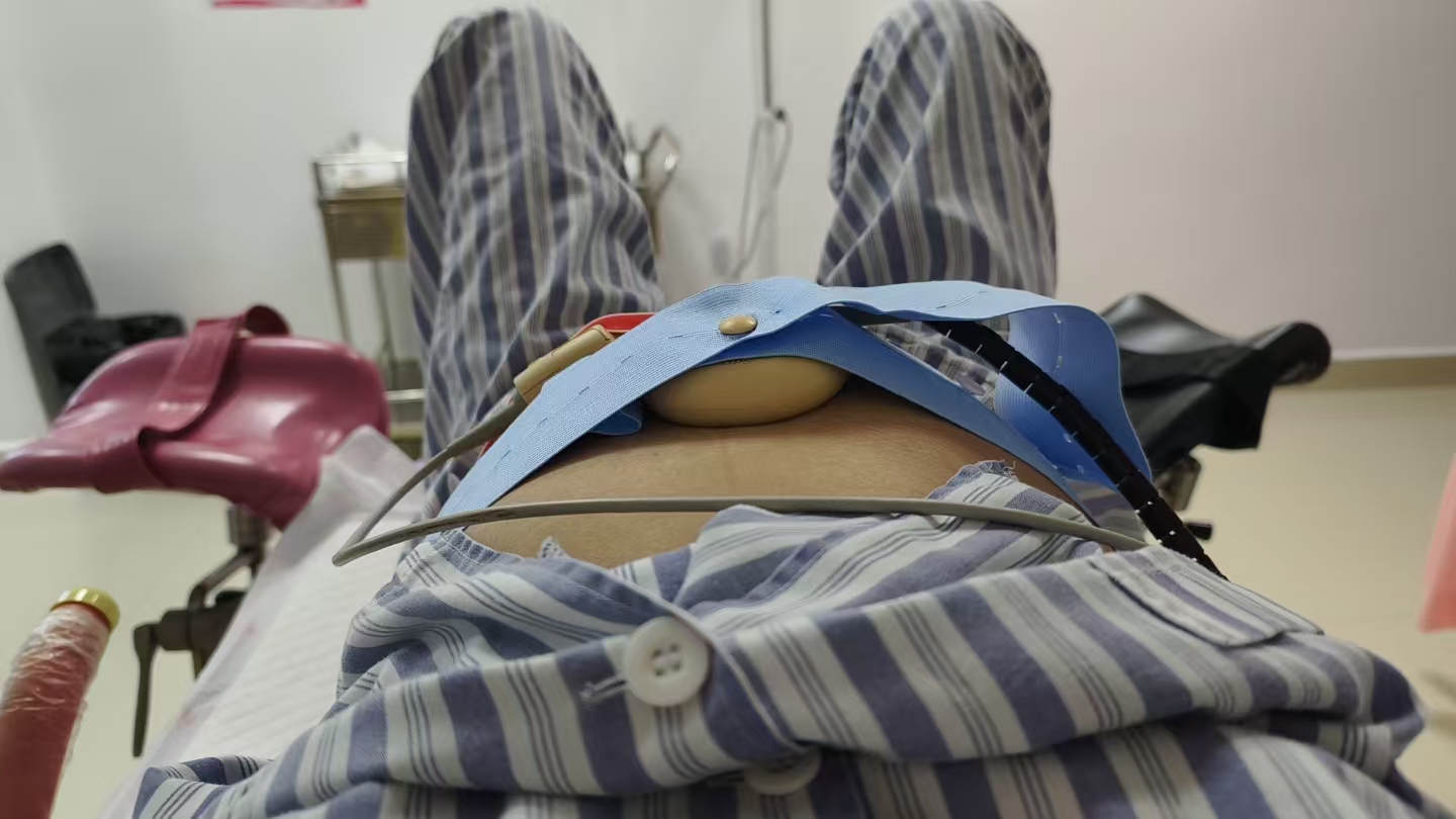 顺产与剖腹产的真实体验分享