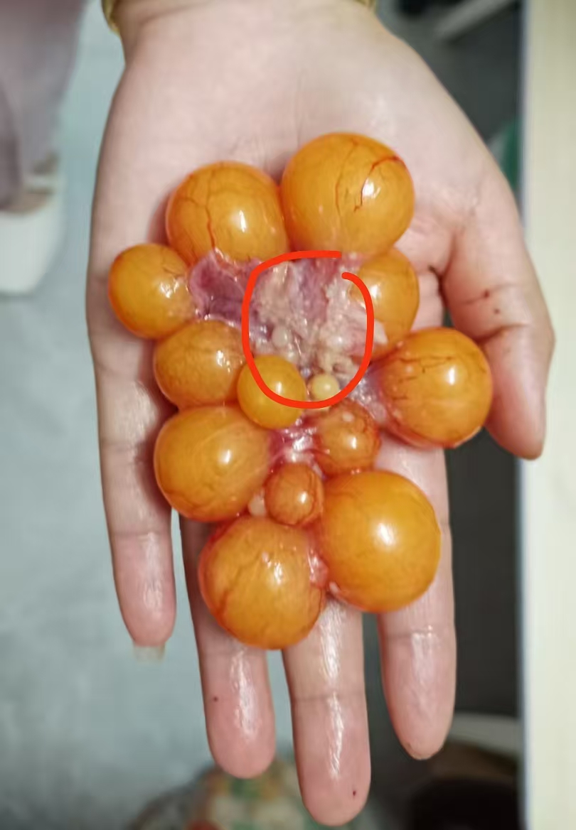 备孕期间的小烦恼