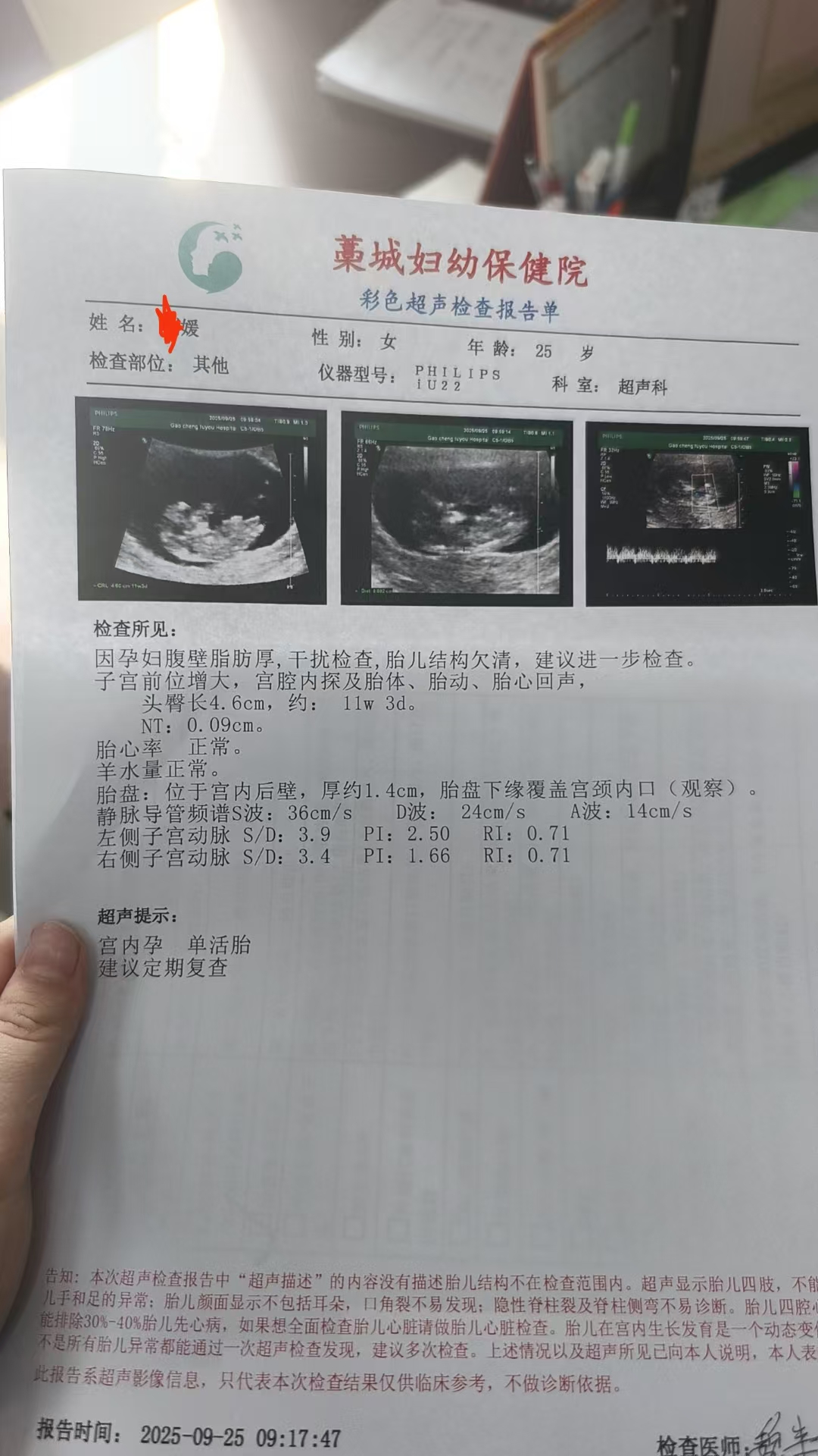 孕期胎盘低置的困扰与应对