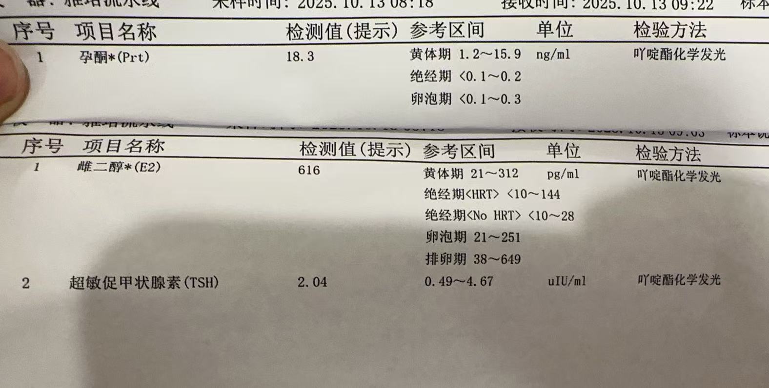 孕期检查的那些事儿