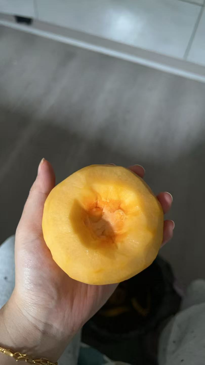孕期胎动频繁的烦恼