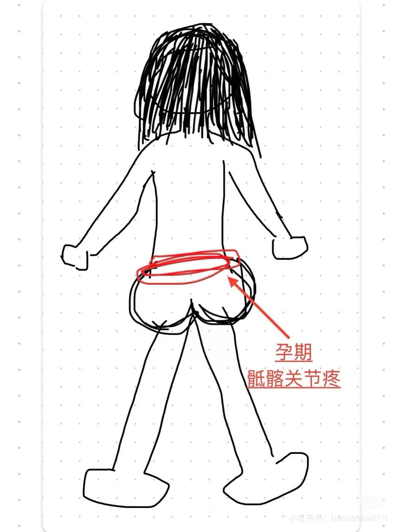 孕期腰痛自救指南