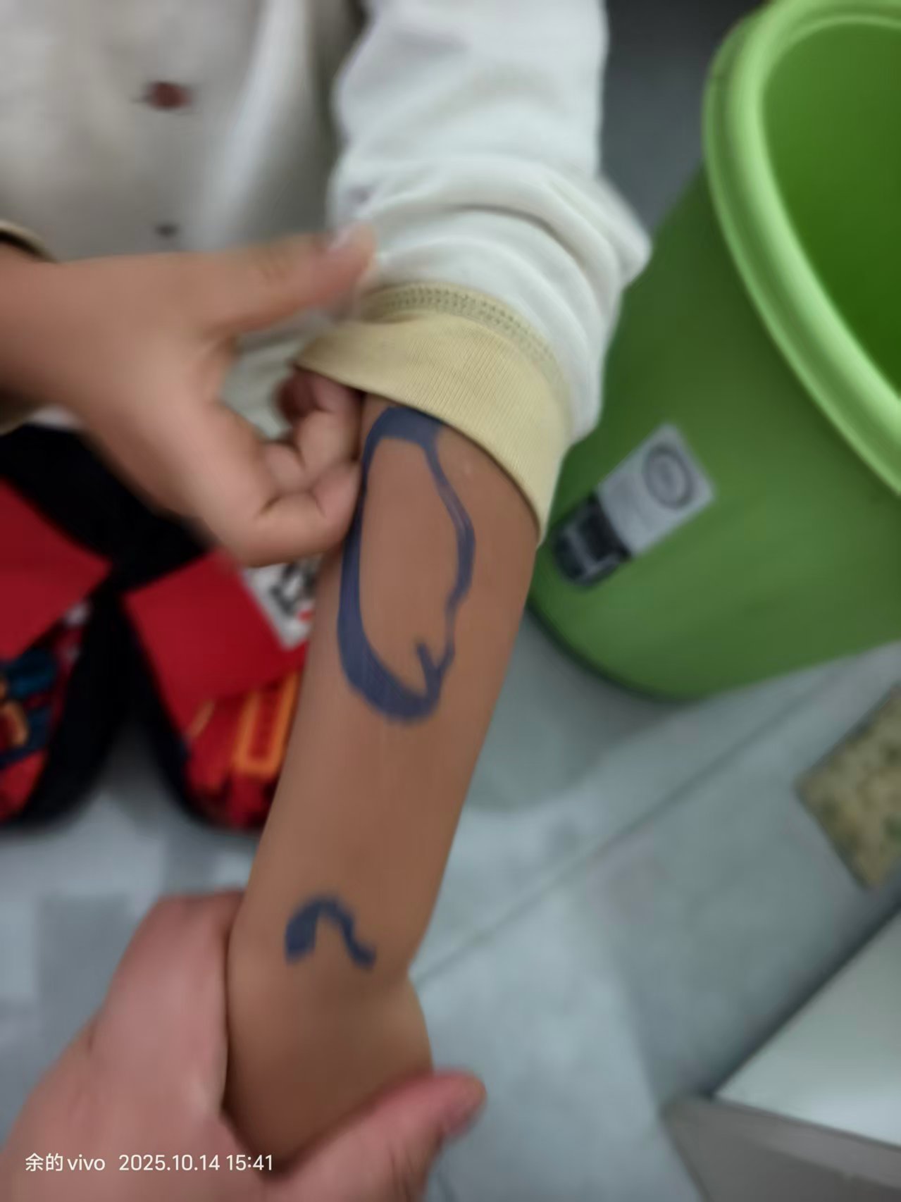 孩子生病期间的烦恼与担忧