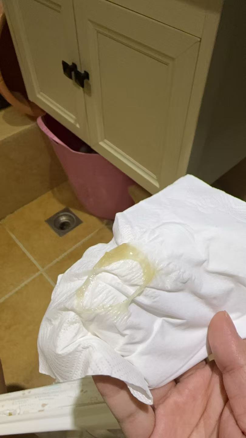 孕期宫缩的烦恼