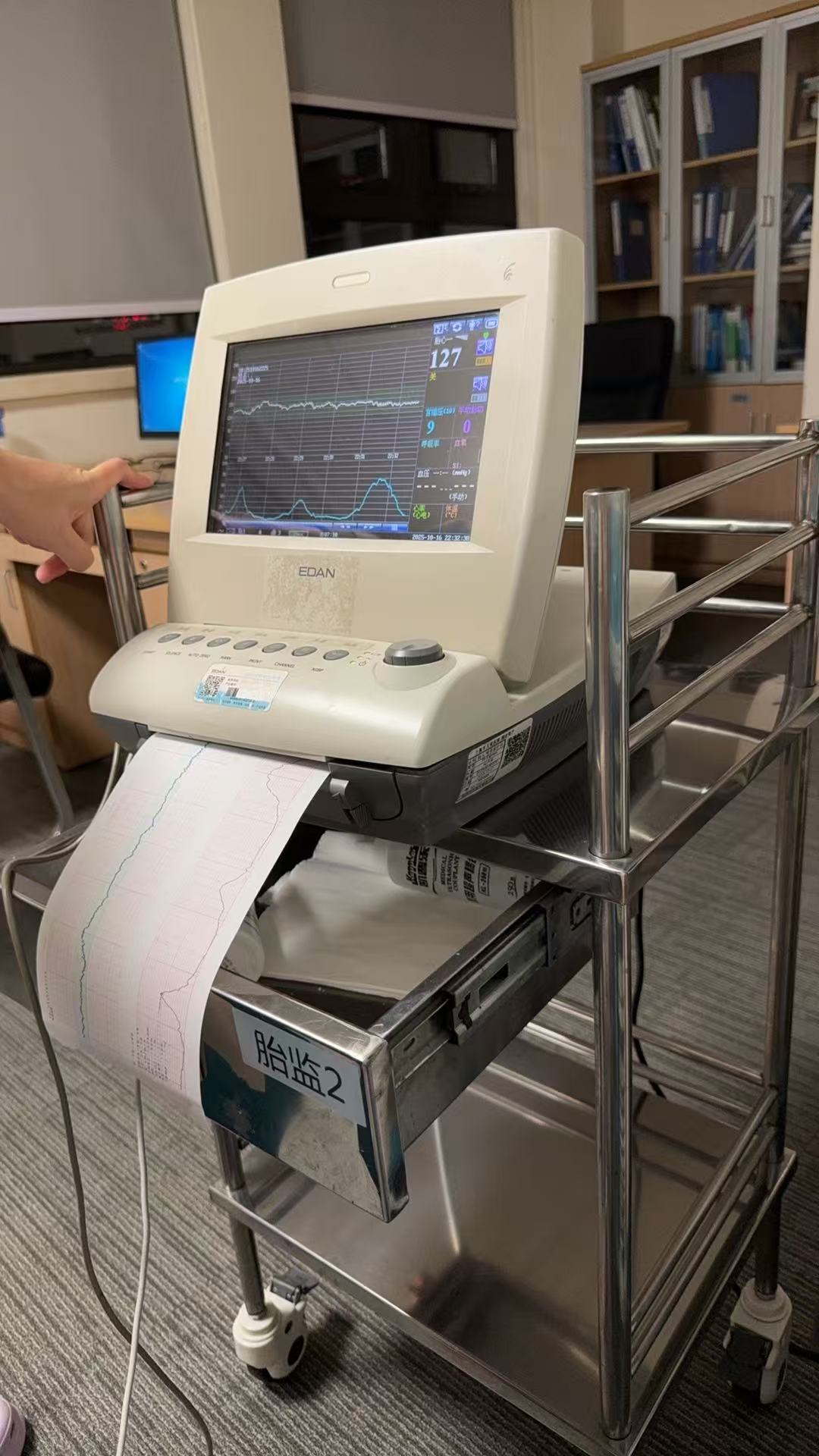 孕期宫缩的烦恼