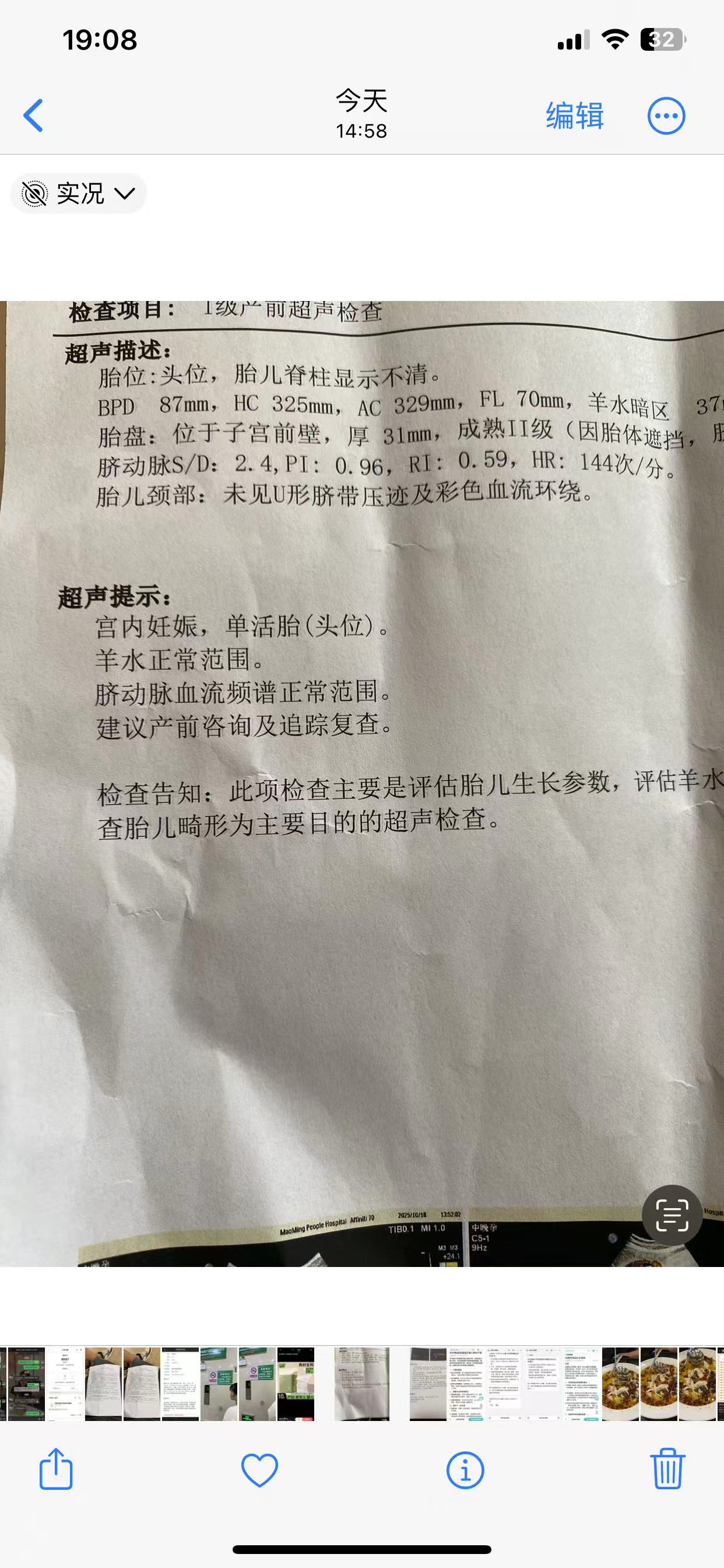 孕晚期B超显示胎儿偏小怎么办