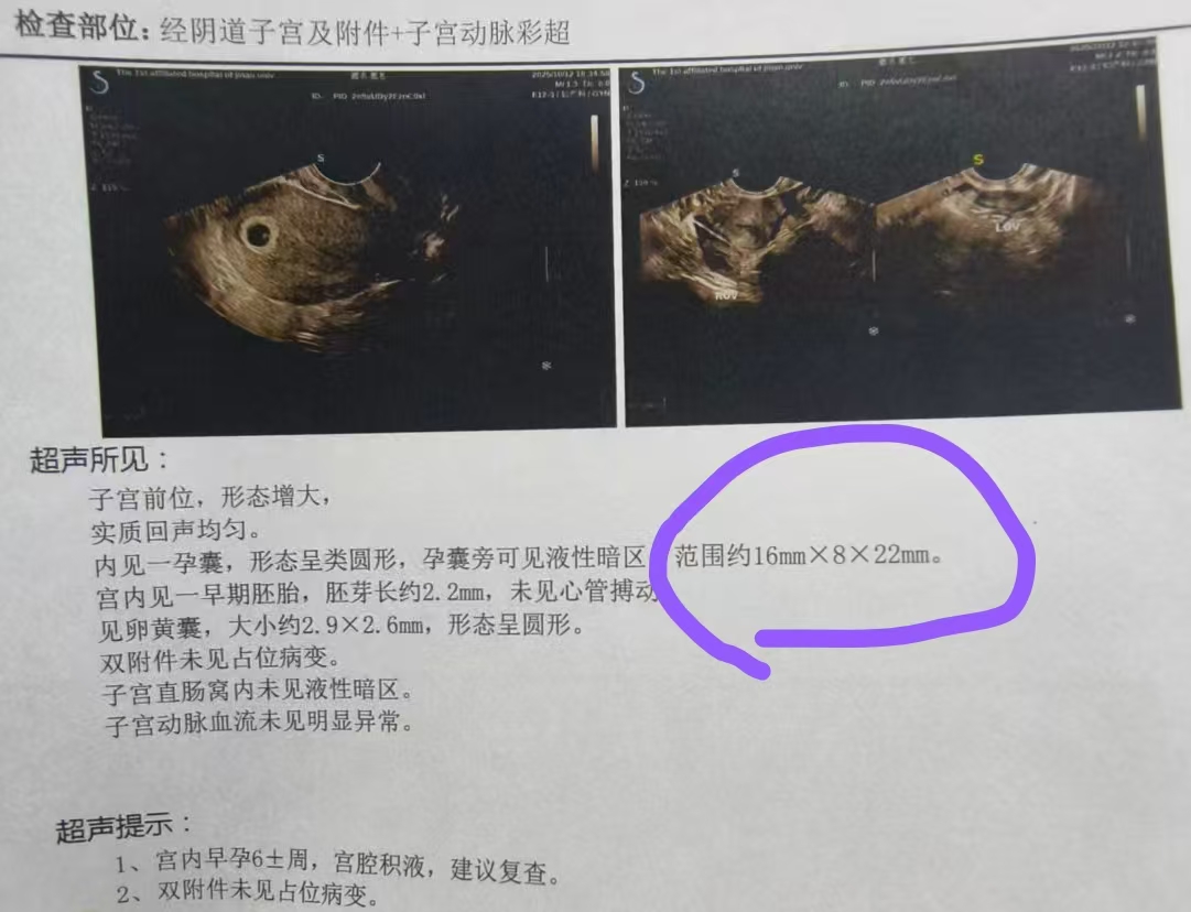 孕早期检查与孕吐缓解经验分享