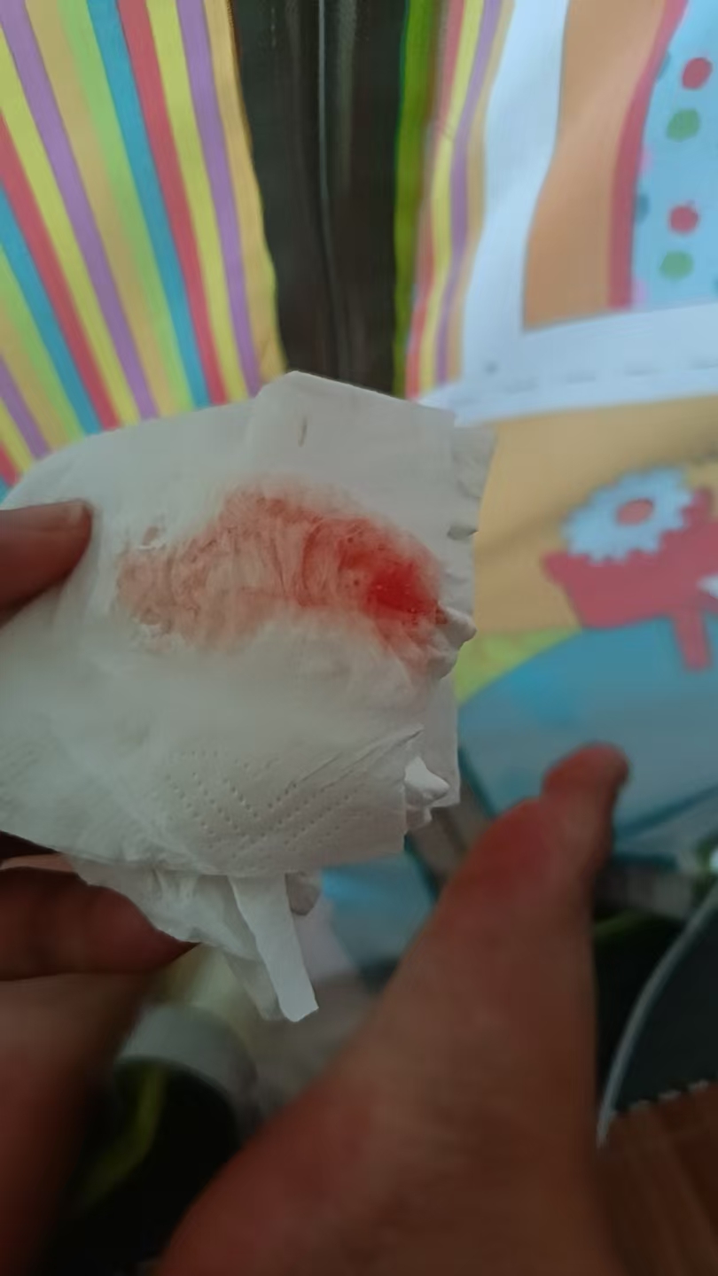 同房后出血是月经还是怀孕征兆？