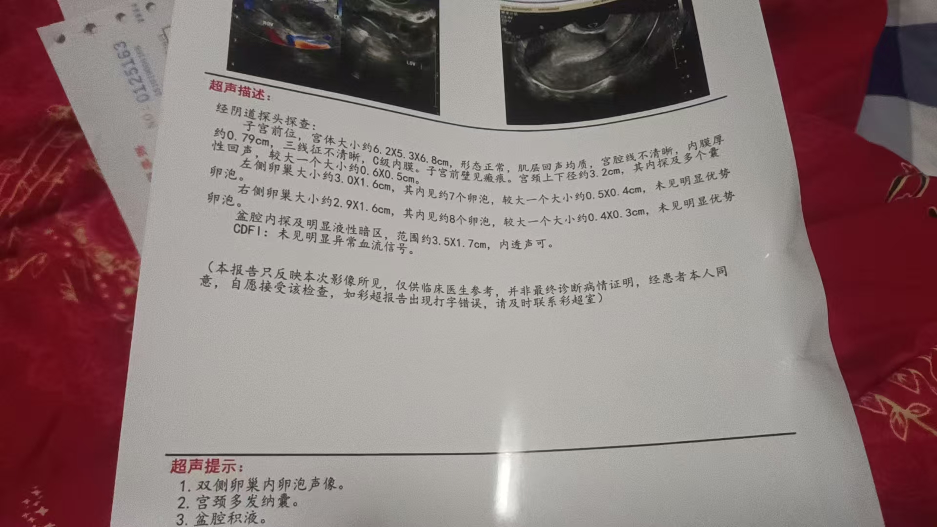 备孕路上的困惑与检查经历
