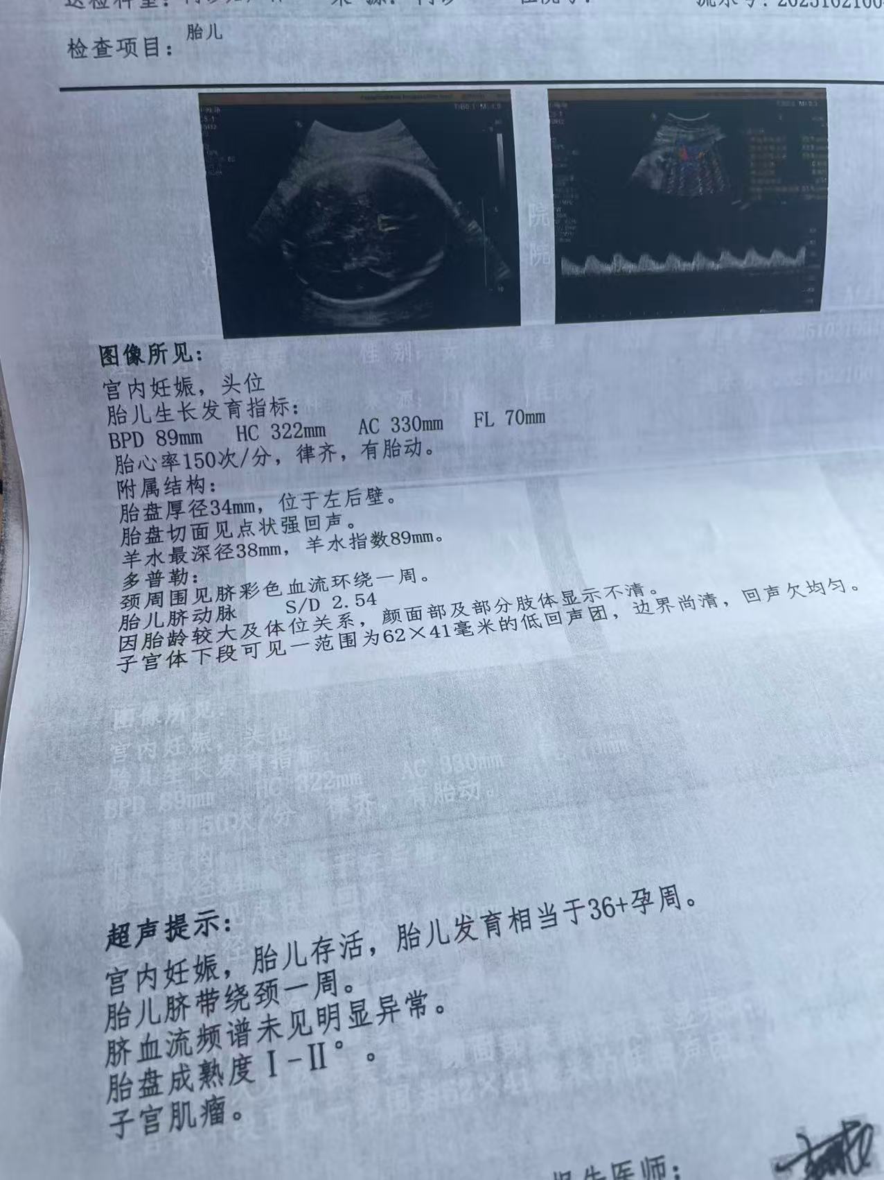 孕期最后阶段的困惑与期待