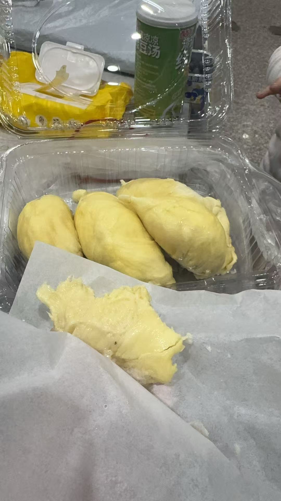 孕期不适与应对经验分享