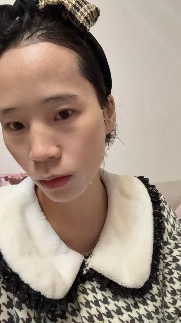 孕期耻骨疼痛的困扰