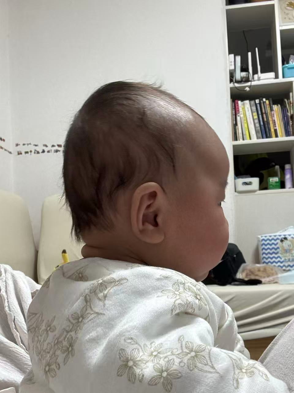 宝宝头型问题求助