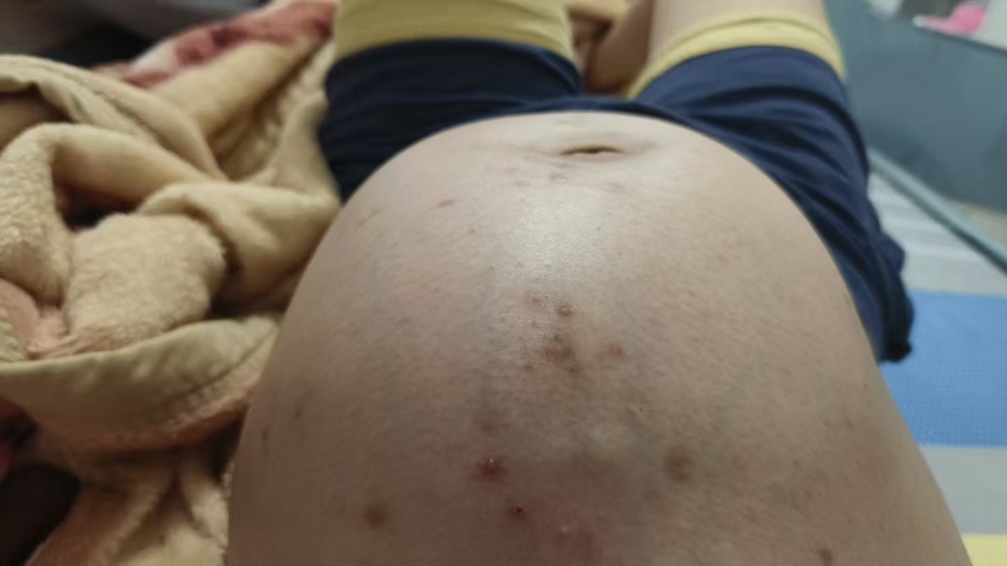 孕晚期数胎动正确方法