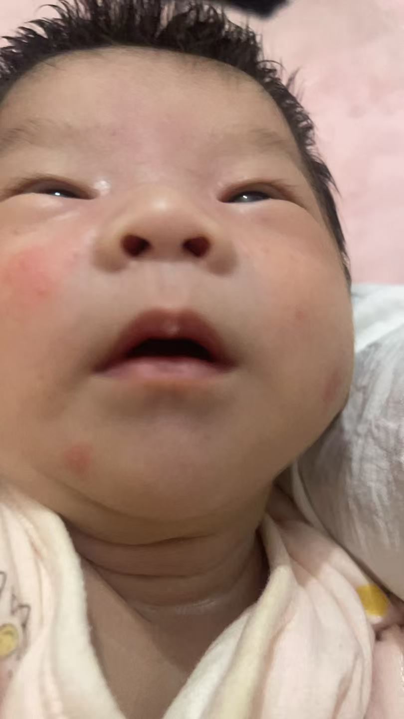 产后恢复与月子护理的烦恼