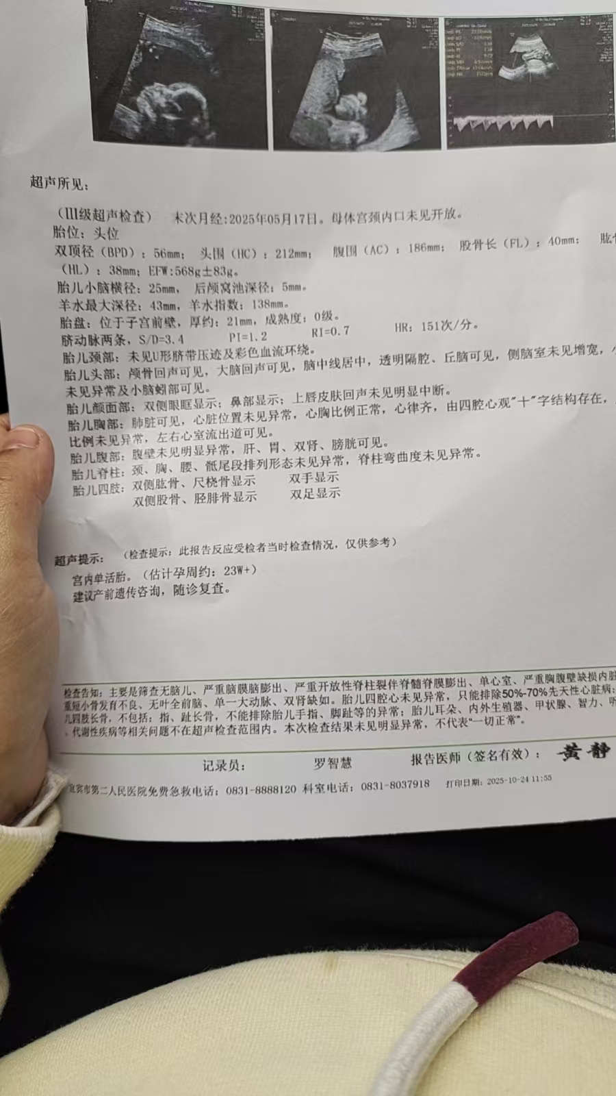 孕期产检的那些事儿