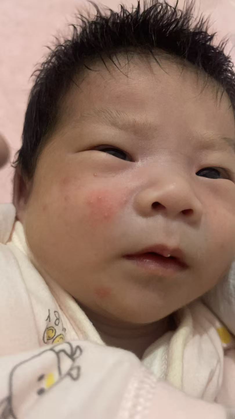 产后恢复与月子护理的烦恼