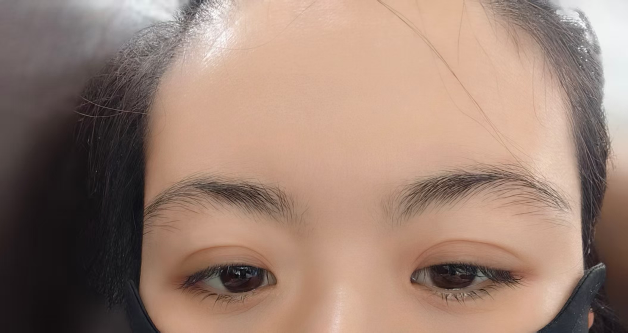 孕期低血糖困扰