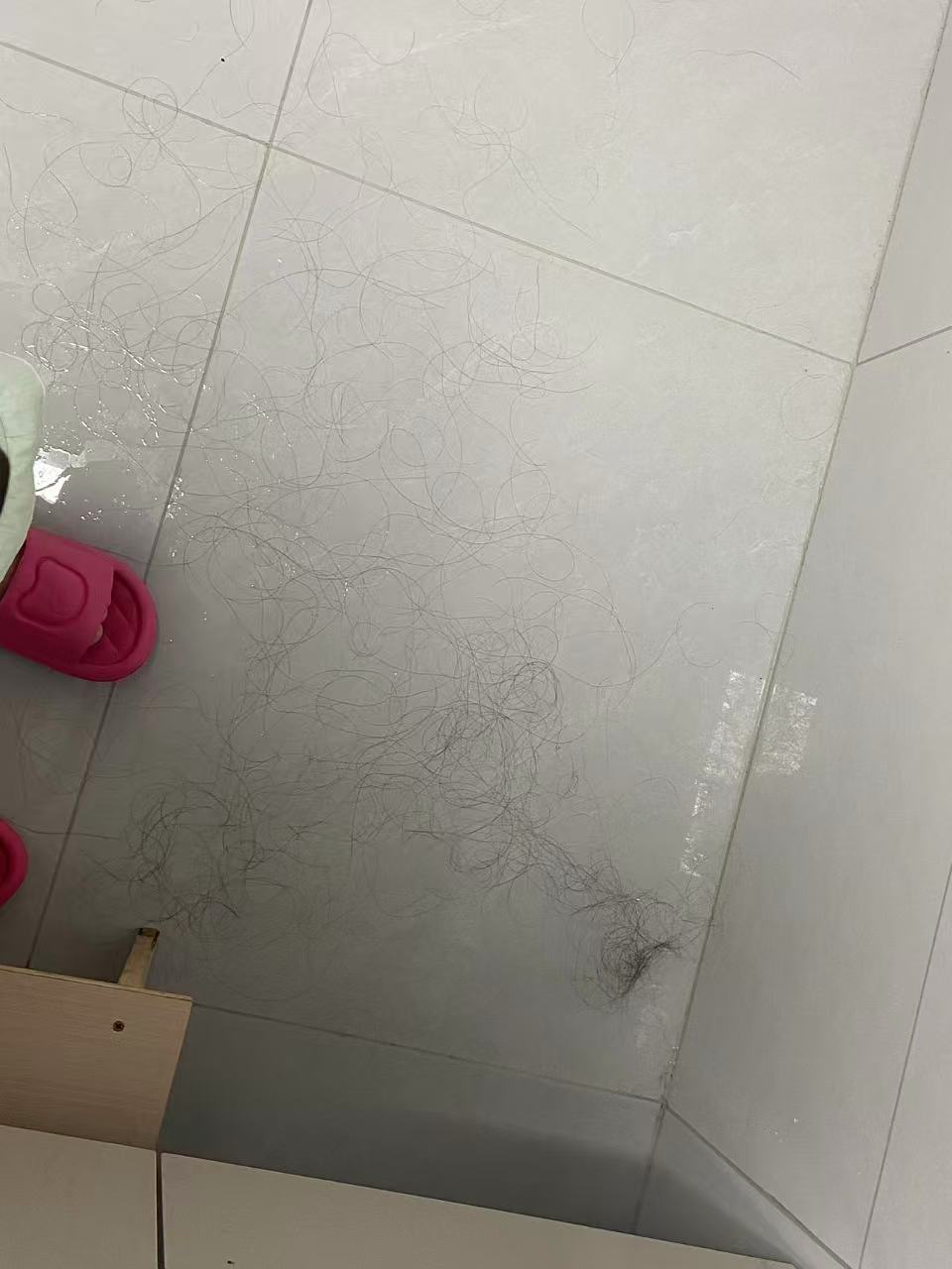 产后脱发困扰