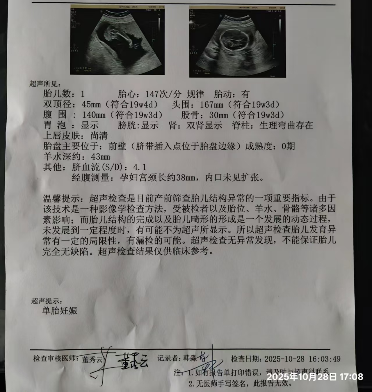 孕期营养与胎儿偏小问题