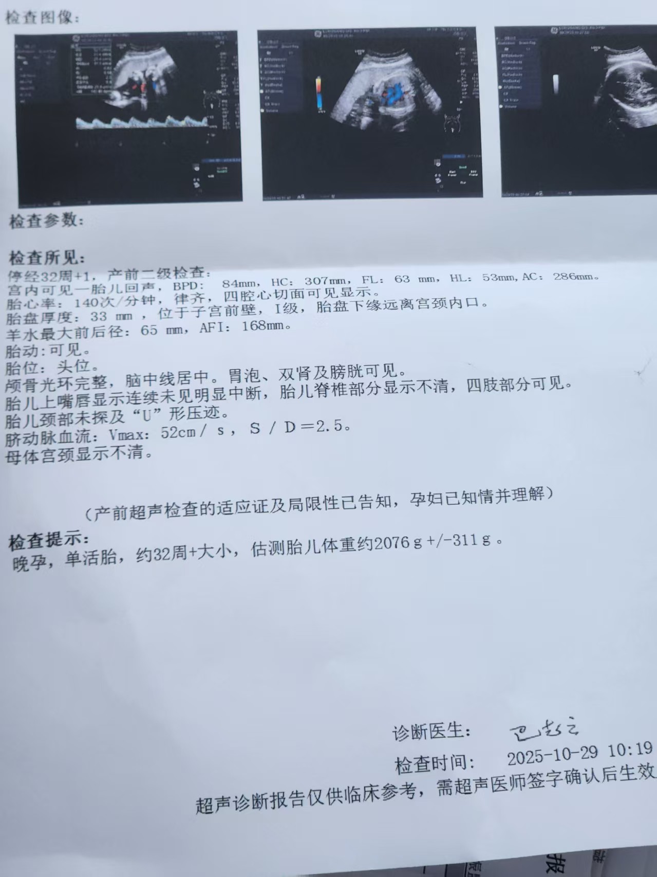 孕期无聊的日常与待产准备