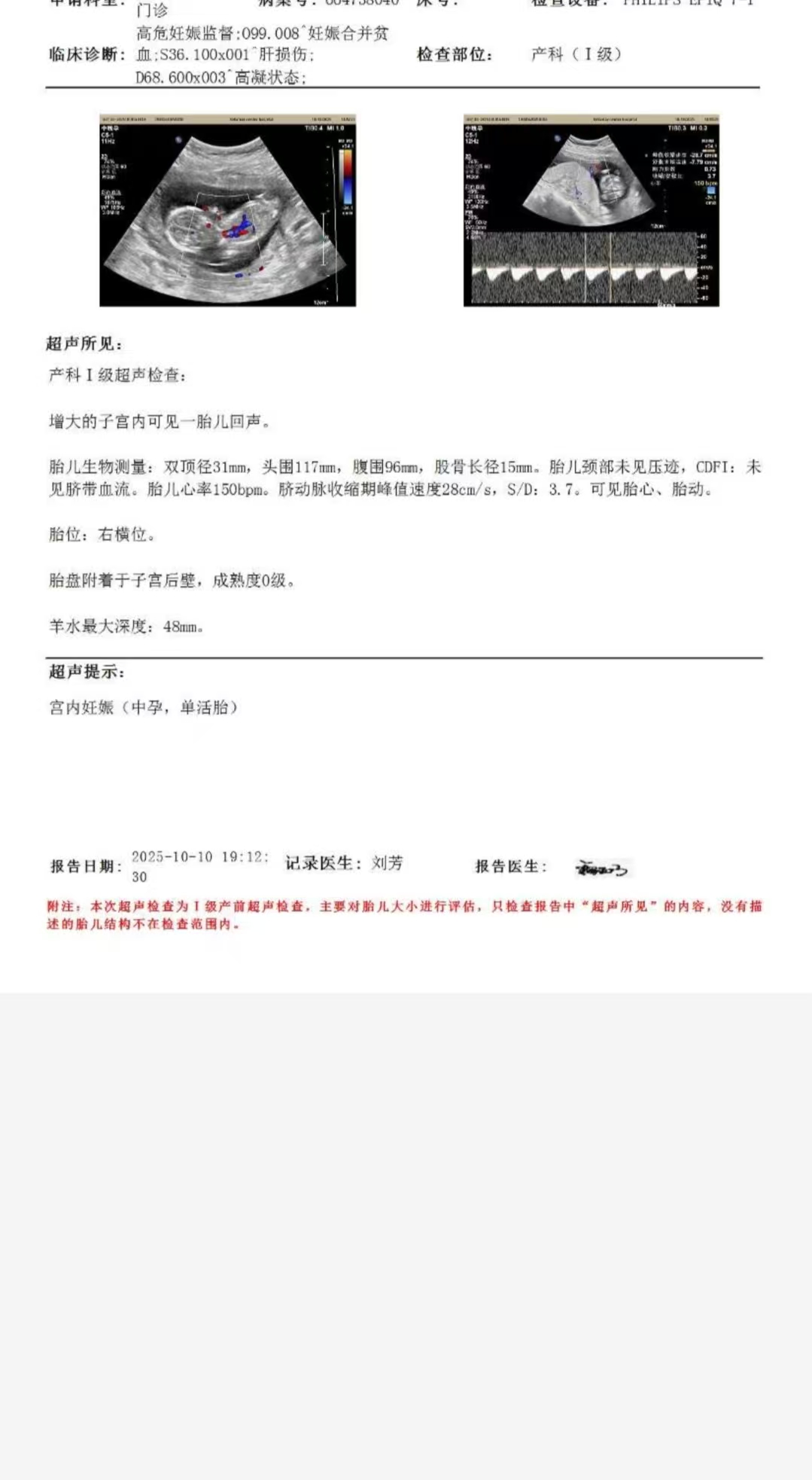 无创vs唐筛选择指南