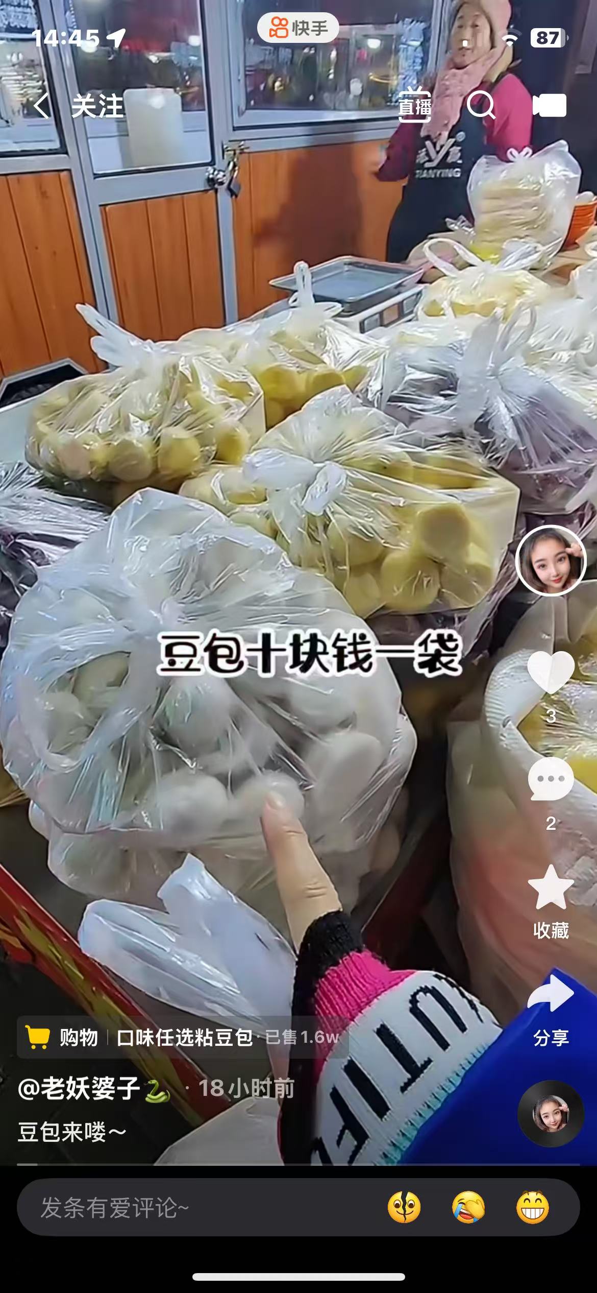 孕期控糖的烦恼