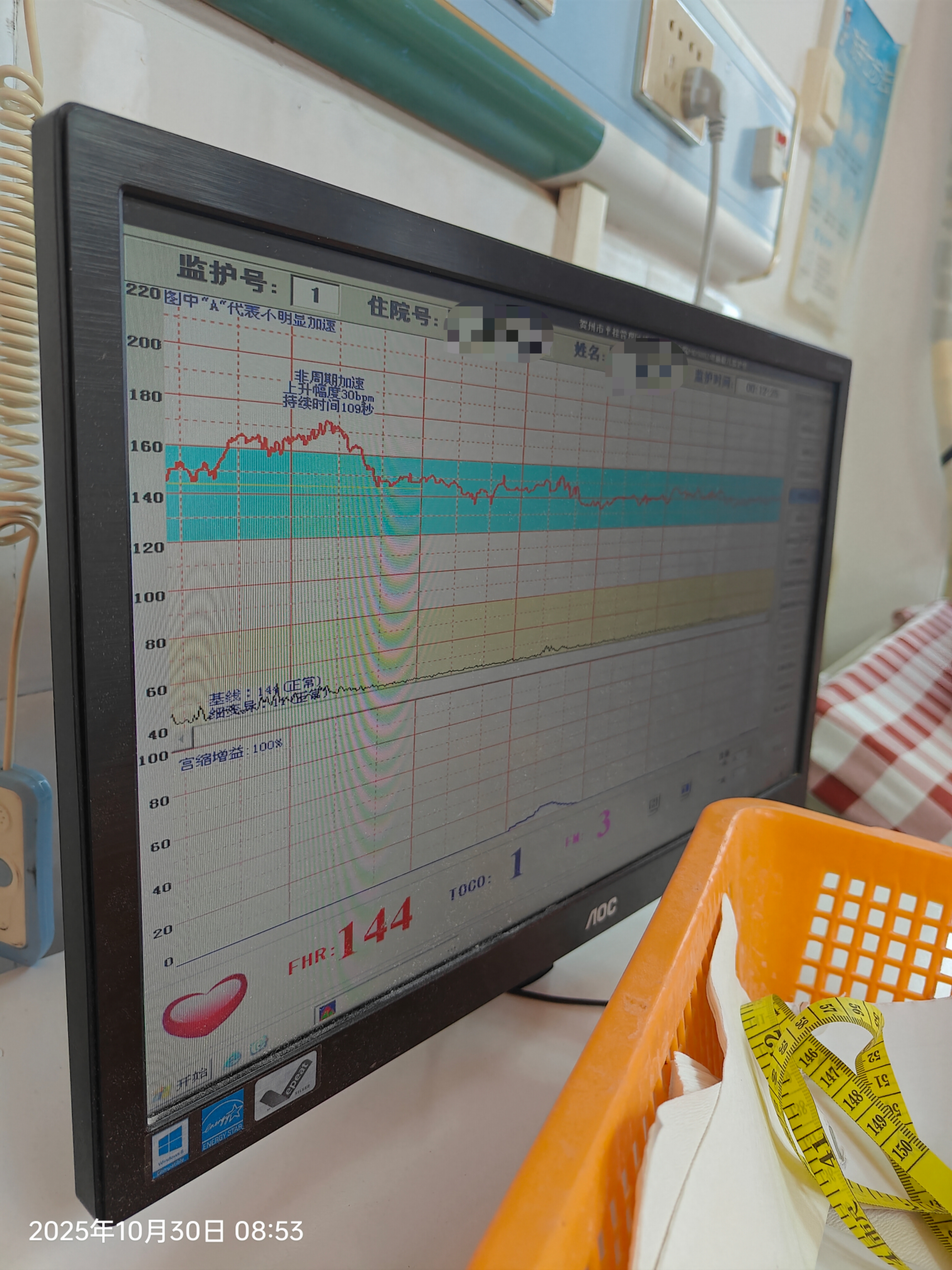 孕晚期胎监经历分享