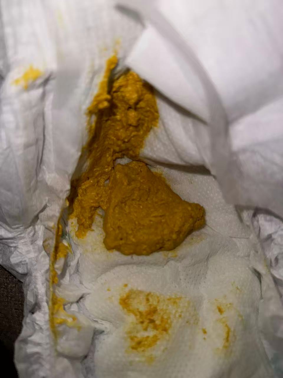 母乳喂养的艰辛与追奶心得