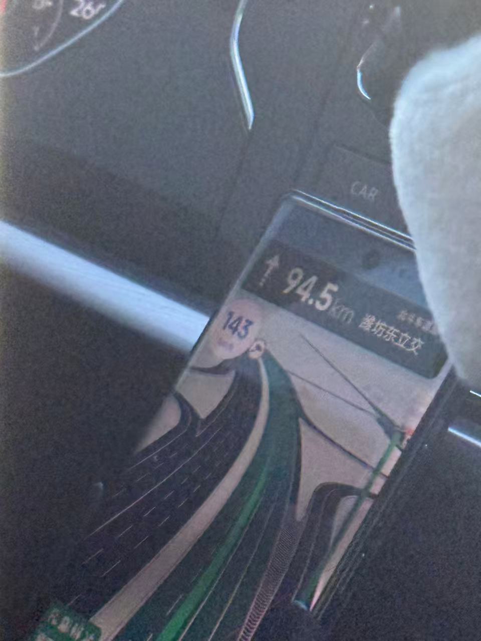 孕期臀位和脐带绕颈的困扰