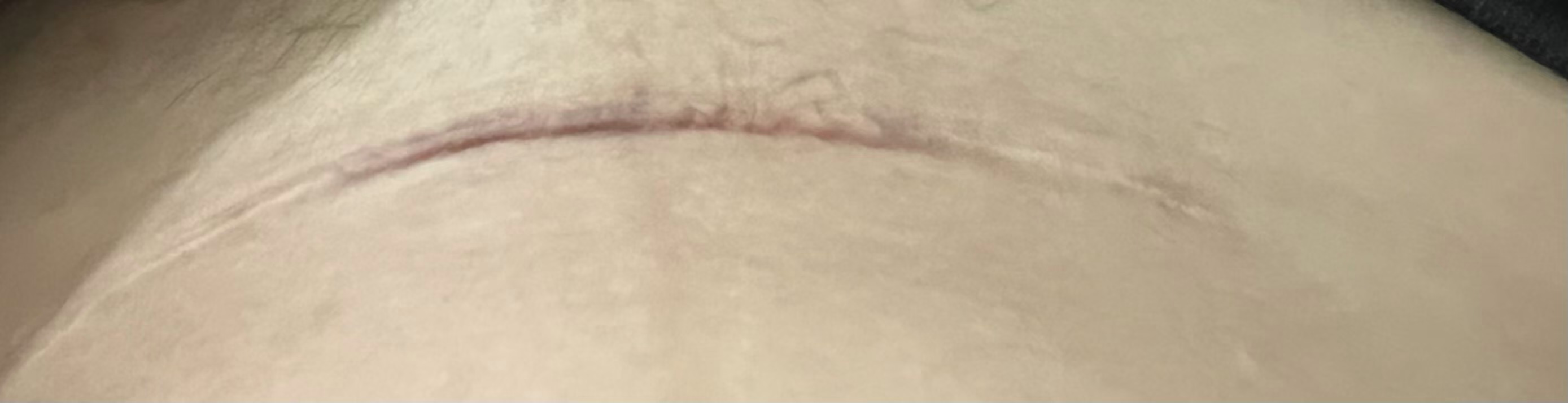 孕期胎动频繁,总是集中在晚上正常吗?