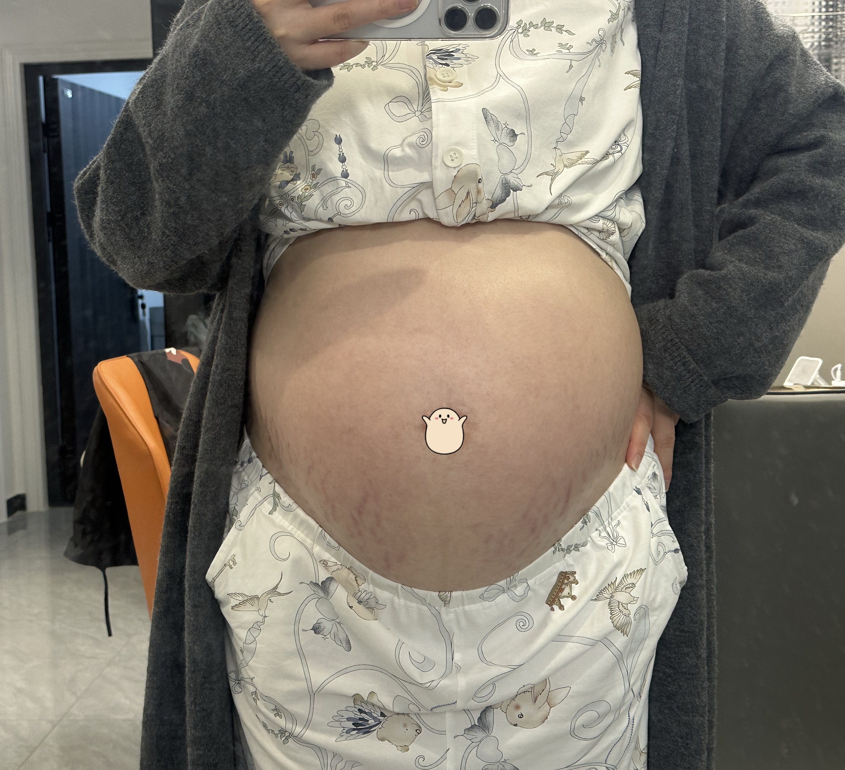 孕期便秘困扰,姐妹们有什么好办法吗?