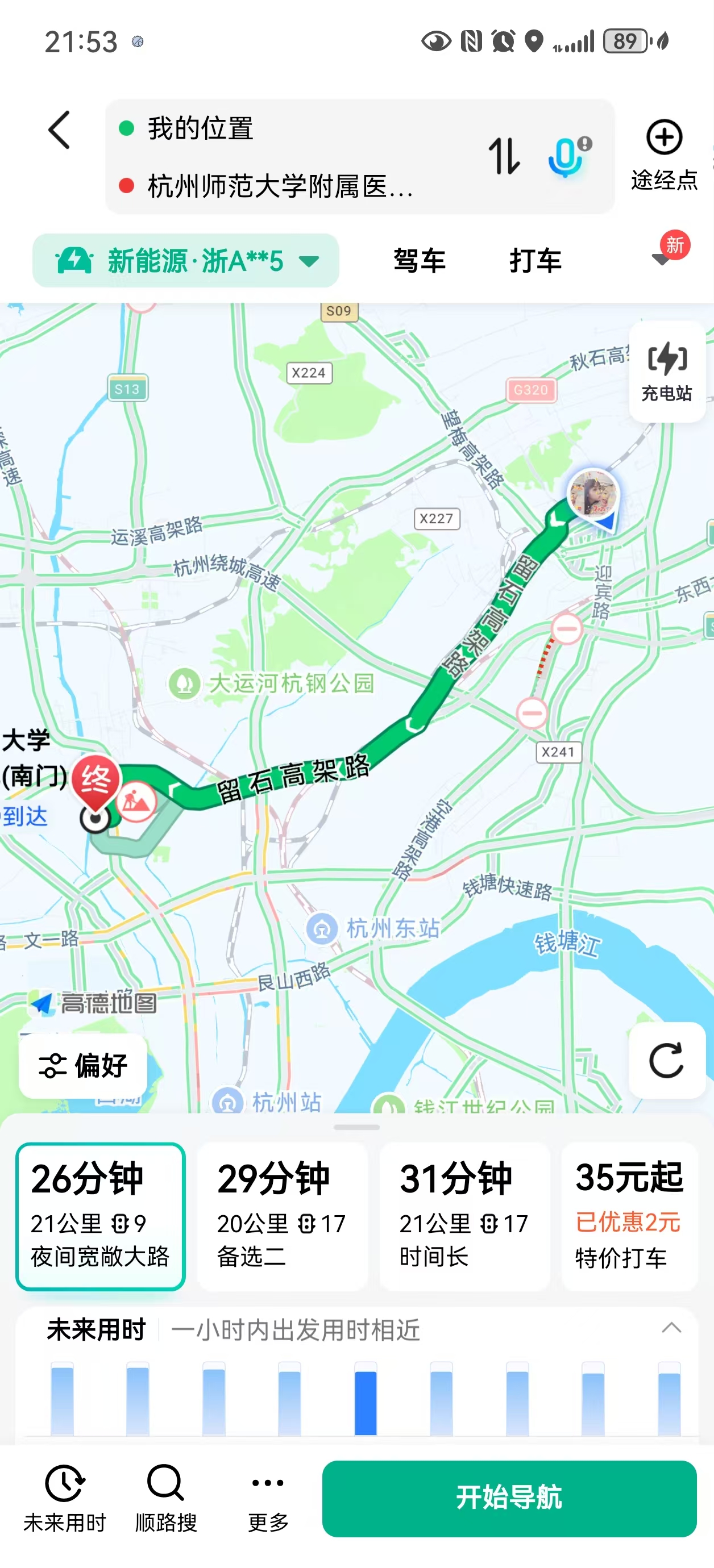 临产前的住院体验