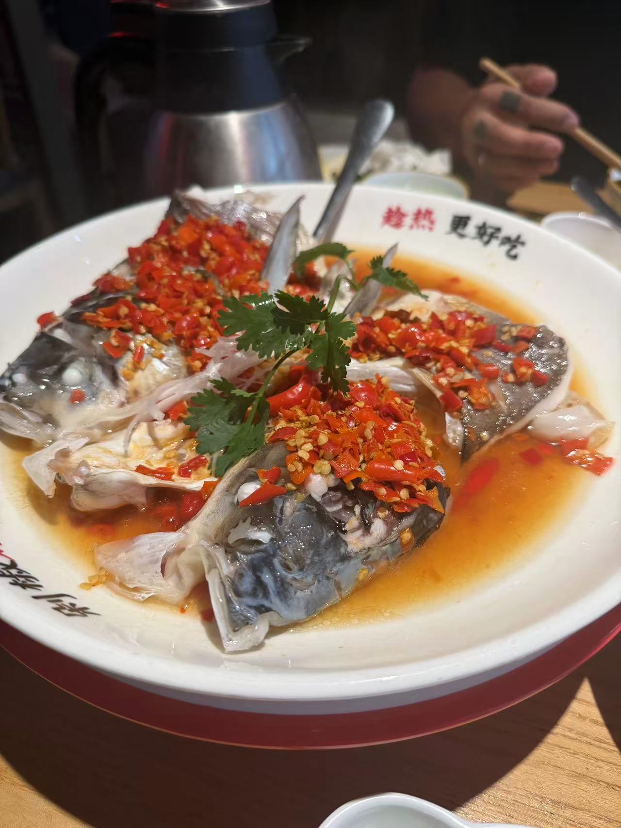 孕期水肿的困扰