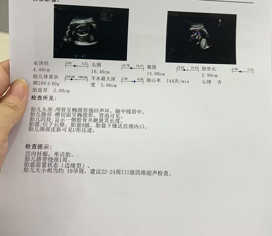 孕期宫颈管短和胎盘低的注意事项